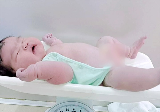 Mẹ Hà Tĩnh 41 tuổi sinh con khó khăn, bé ra đời với cân nặng 6,2kg hiếm thấy - 1