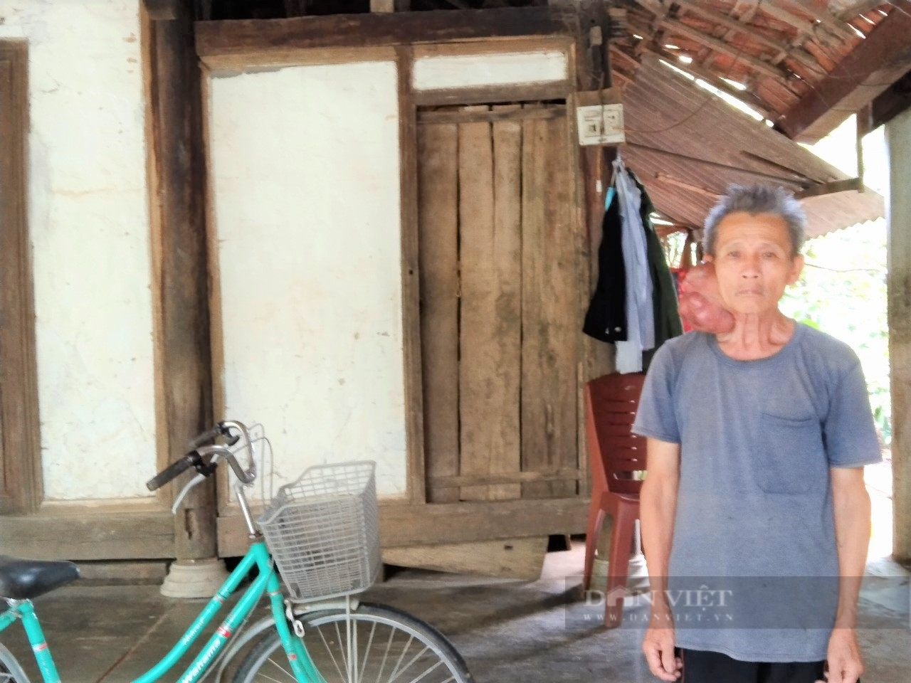 Hà Tĩnh: Nỗi khổ cụ ông 73 tuổi mang khối u lạ nặng 1kg ở cổ, bán hết cả gia tài vẫn chưa khỏi bệnh - Ảnh 3.